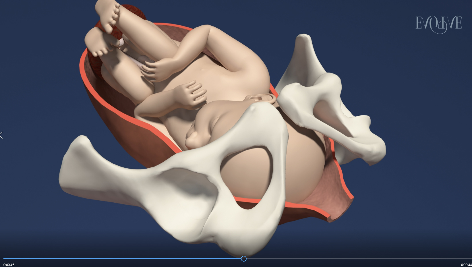 The stages of normal childbirth - Medical animation